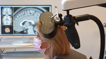 une personne est vue de profil, un appareil en forme de huit posée sur le front. En arrière plan, un écran avec une image d'IRM de cerveau